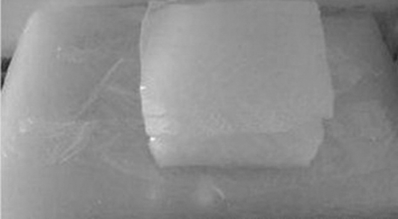 BR是什么？分類品種有哪些